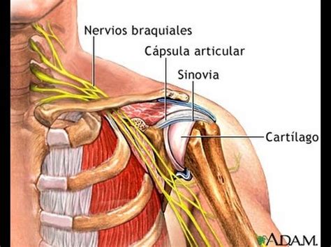 SINOVITIS ACROMIOCLAVICULAR - YouTube