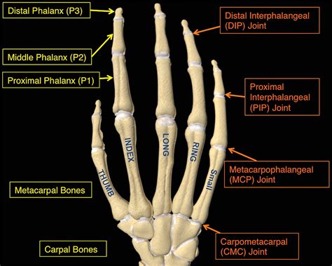 Traumatic Finger Injuries: What the Orthopedic Surgeon Wants to Know | RadioGraphics