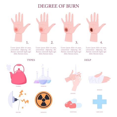 Premium Vector | Skin burn injury treatment and stages infographic.