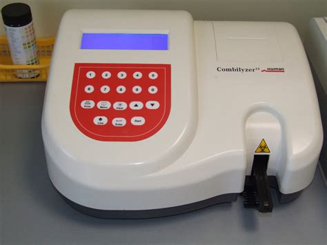 Urine chemistry analyzer | UseScience