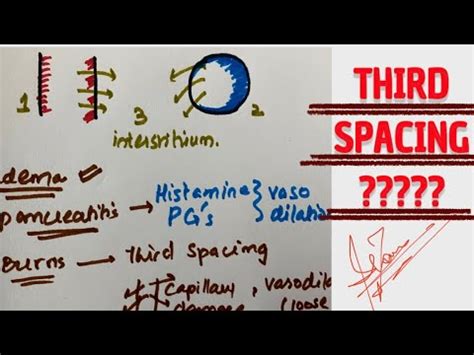 What is THIRD SPACING | CAUSES | MEDICINE with DR SHAMAMA - YouTube