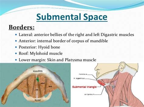 Abscess and phlegmon in maxillofacial region odontogenic infections-