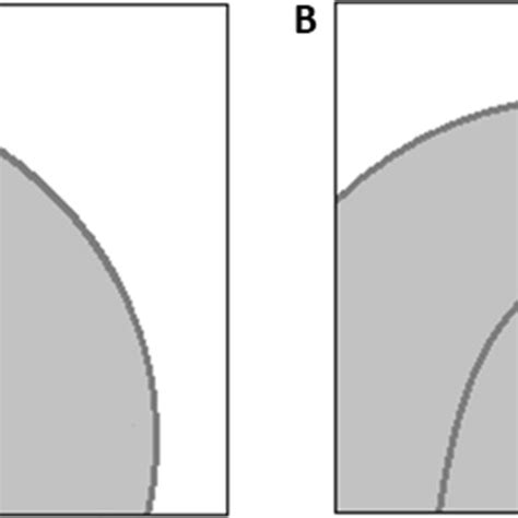 Schematic of the cyst feature examined on cross-sectional imaging ...