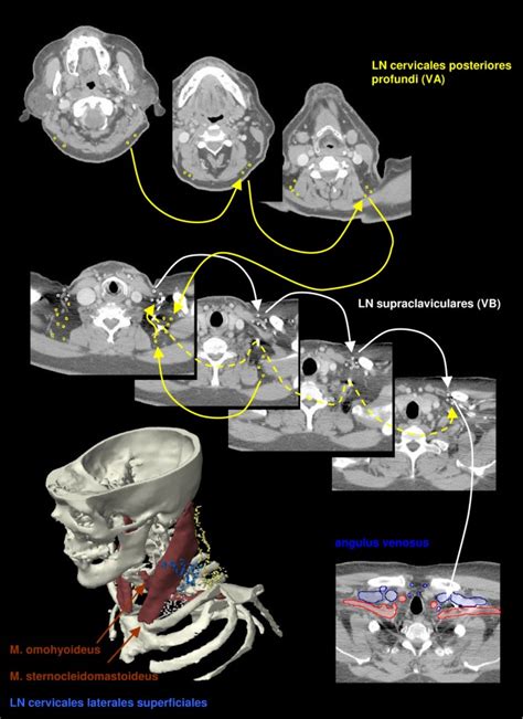 Guidelines for delineation of lymphatic clinical target volumes for high conformal radiotherapy ...