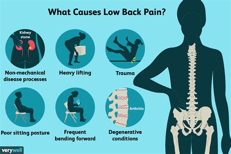 Sciatica | Lumbar Disc | Back Pain Treatment | The Pain Relief Practice