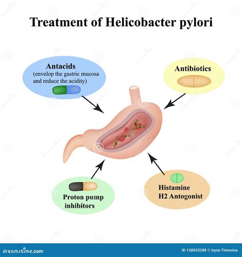 Treatment of Helicobacter Pylori. Medications. Antacids, Proton Pump ...