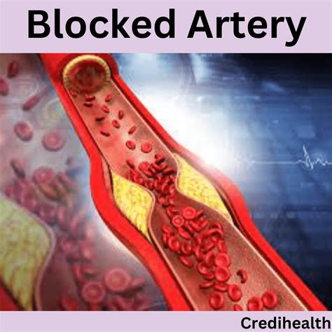 Bacterial Infection Mouth: Causes, Symptoms and Treatments | Credihealth