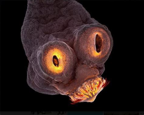 Taenia solium. Tapeworm magnified at 200x, an intestinal parasite found ...