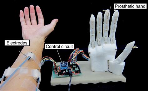 Controlling Arduino Based Robotic Arm Through Emg Dat - vrogue.co