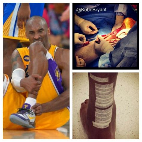 Kobe Bryant's Achilles injurythen surgery last season. Nike Tennis, Achilles, Kobe Bryant ...