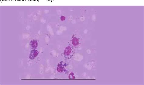 Figure 2 from Azurophilic inclusions in plasma cells. | Semantic Scholar