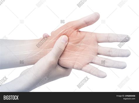 Hand Nerve Pain White Image & Photo (Free Trial) | Bigstock