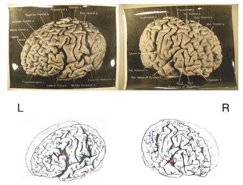 Albert Einstein's Brain May Provide Clues To His Genius, Study Says ...