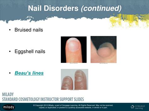 PPT - Chapter 10 Nail Disorders and Diseases PowerPoint Presentation, free download - ID:1076373