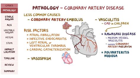 Cad Pathophysiology Nursing - PELAJARAN