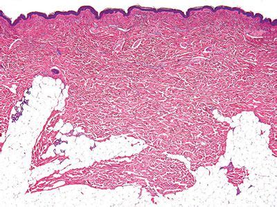 Histology of the Skin | Plastic Surgery Key