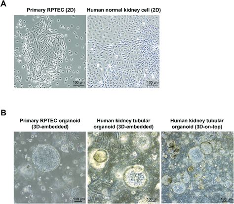 Primary renal proximal tubular epithelial cells (RPTECs) and normal... | Download Scientific Diagram