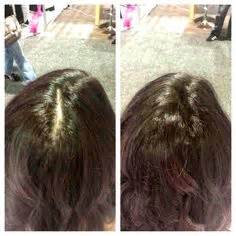 38 Best Viviscal Before & After ideas | viviscal, viviscal before and after, hair growth