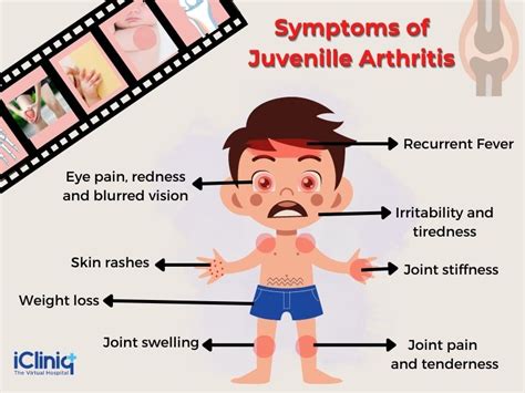 Juvenile Idiopathic Arthritis Causes Symptoms Diagnos - vrogue.co