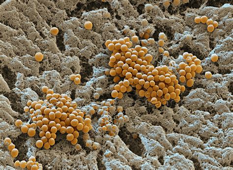 Bacteria and Fungus seen in the Scanning and Transmission Electron Microscope - scientific ...