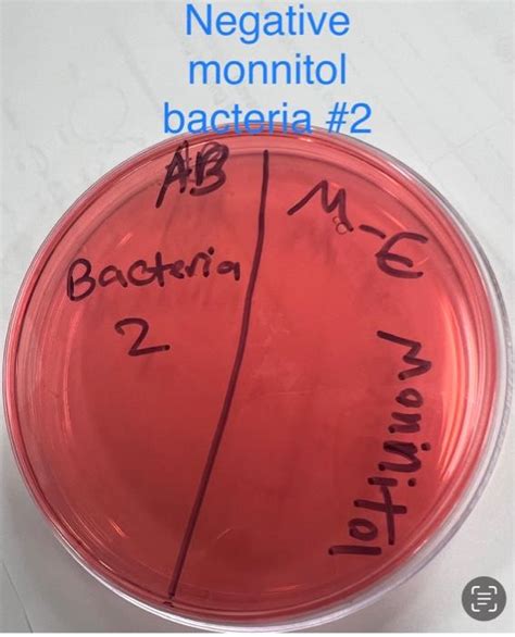 Solved MSA Plate | Chegg.com