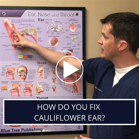 How Do You Fix Cauliflower Ear? — Dr. Luke Shellenberger