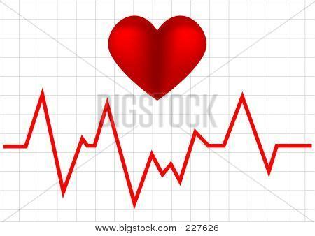 Heart Monitor Graph Image & Photo (Free Trial) | Bigstock