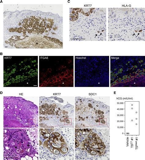 Derivation of Human Trophoblast Stem Cells: Cell Stem Cell