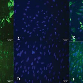 RPE cell characterization. Note the immune reactivity of the cultivated... | Download Scientific ...