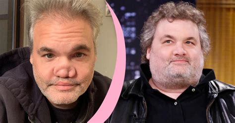 Artie Lange Refuses To Fix His Nose, Here's Why