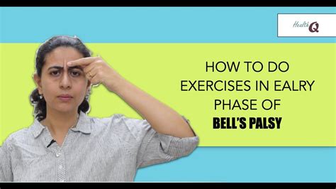 FACIAL EXERCISES IN EARLY PHASE OF BELL'S PALSY - YouTube