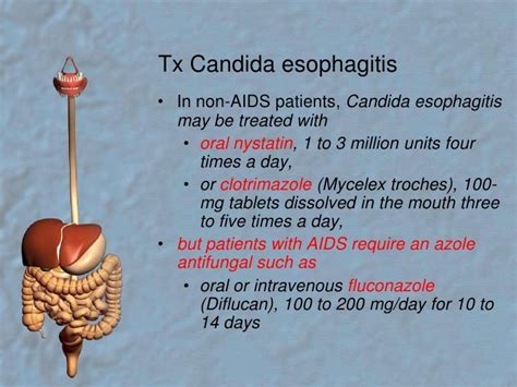 Esophagitis