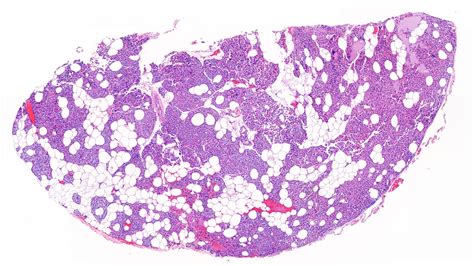 Parathyroid Histology Labeled