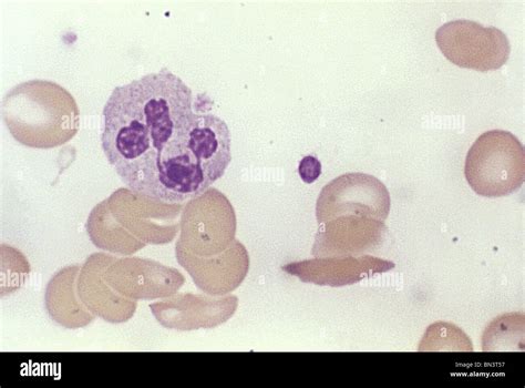 Light micrograph of a normal blood smear showing platelets, a leukocyte and red blood cells ...