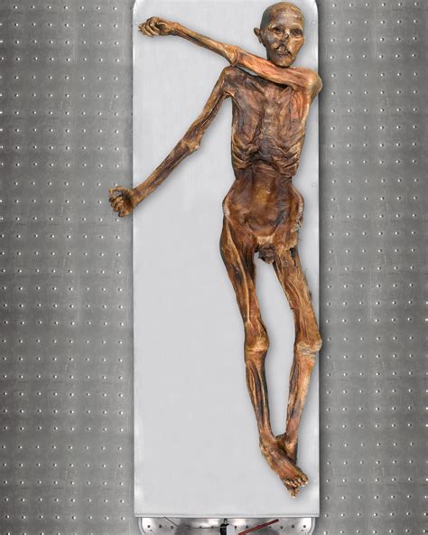 Iceman Otzi had dark skin and male pattern baldness, analysis reveals