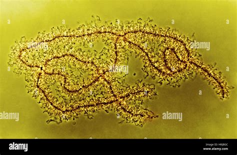 Lampbrush Chromosomes (Newt), LM Stock Photo - Alamy