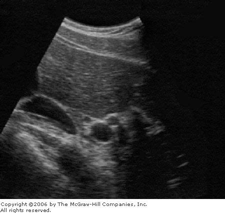 WK 3 PORTAL TRIAD | Ultrasound, Emergency medicine, Emergency