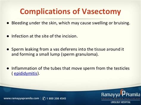 Vasectomy