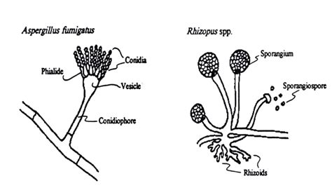 Aspergillus fumigatus: Morphology, Pathogenesis, Lab Diagnosis