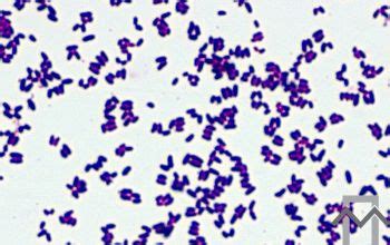 Corynebacterium striatum