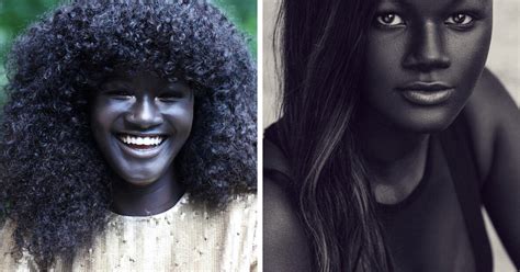 Teen Bullied For Her Incredibly Dark Skin Color Becomes A Model, Takes The Internet By Storm ...