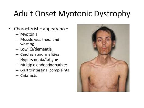 PPT - Modeling Childhood-onset Myotonic Dystrophy PowerPoint Presentation - ID:1999811