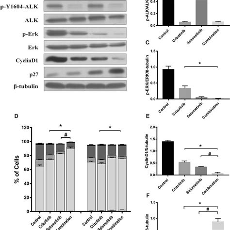 Crizotinib combines with selumetinib to suppress growth of crizotinib ...