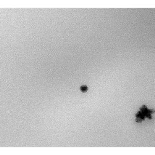 TEM image at 49,000 magnification. | Download Scientific Diagram