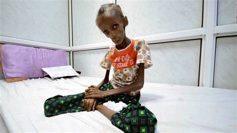 Yemen food crisis leaves millions at risk of starving - CNN