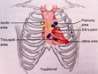 APe To Man (Heart Auscultation) Flashcards | Quizlet