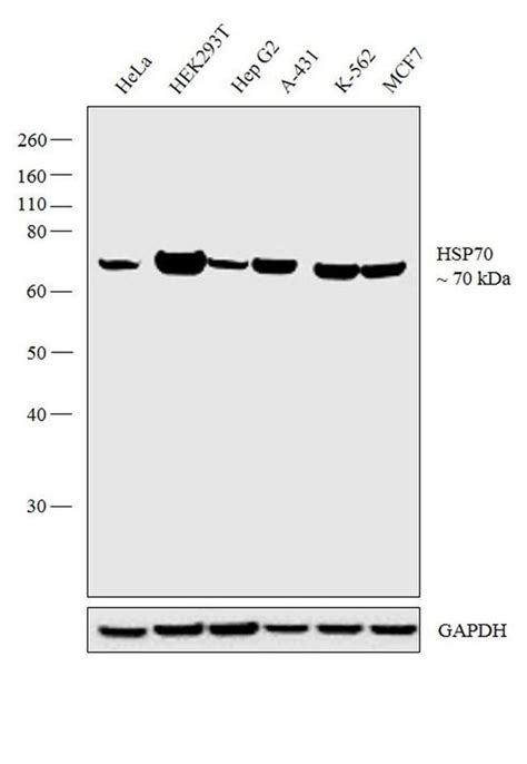 HSP70 Monoclonal Antibody (4G4) (MA3-009)