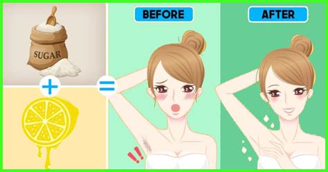 How to Remove Hair at Home | AAI-NY