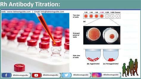 antibody screening panel | Lab Tests Guide