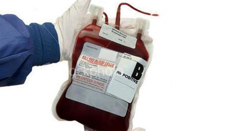 How Much Is A Pint Of Blood | Public Health